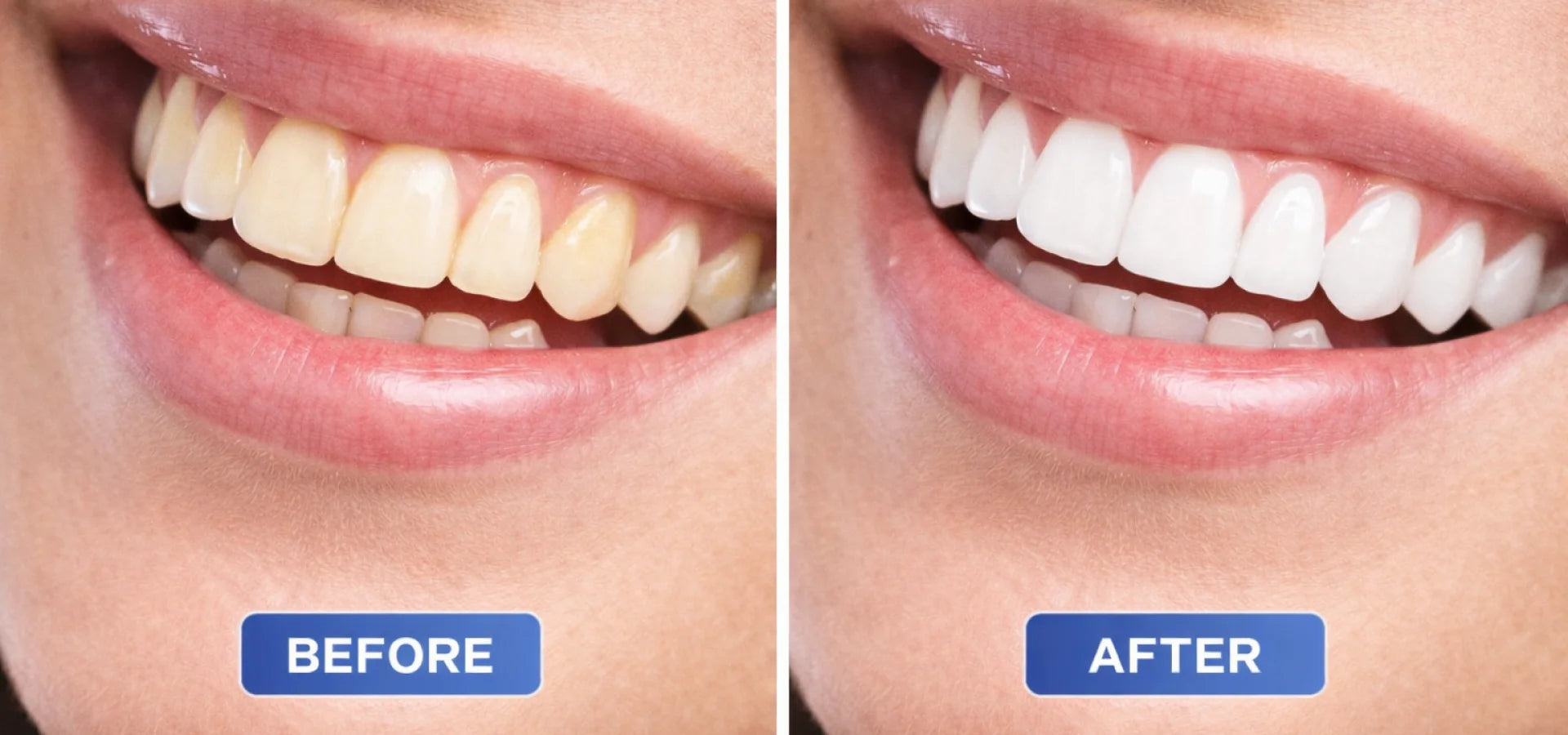 slider image slider_item_FjkNhR