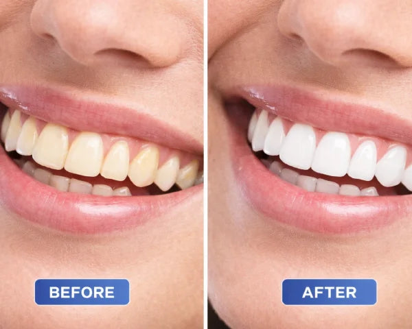 slider image slider_item_FjkNhR